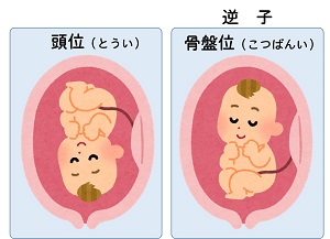 逆子治療 神戸針灸接骨治療院